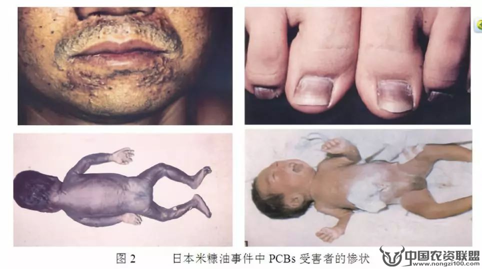 附件